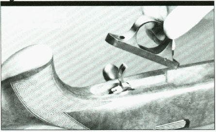 Browning A-Bolt (Pre-1993) Trigger Guard Figure 12